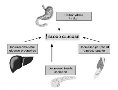 diabetes mellitus type 2 signs and symptoms