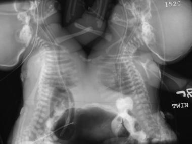 A superior radiographic view of the same set of tw