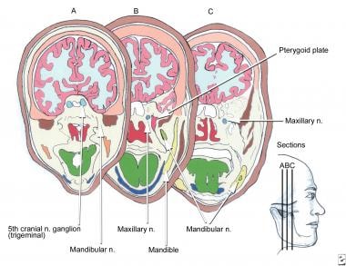 Pertinent coronal anatomy with regard to trigemina