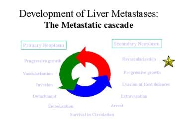 Liver, metastases. The metastatic cascade in the d