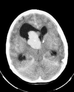 Image obtained in a patient who presented at age 1