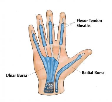 Flexor tendon sheaths and radial and ulnar bursae.