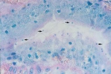 Hematoxylin and eosin stain of intestinal epitheli