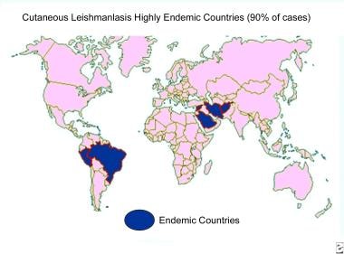 Distribution map of cutaneous leishmaniasis. 