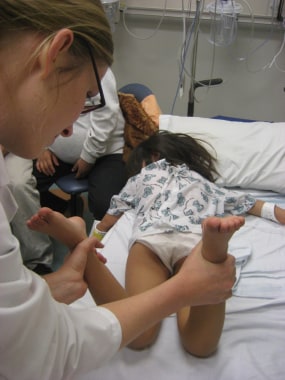 little girls in frog position Medical examination Pediatric Limp Clinical Presentation: History, Physical Examination