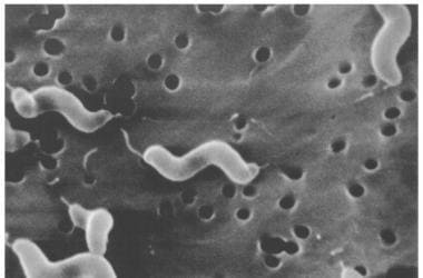 Scanning electron microscope image of Campylobacte