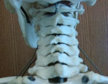 Cervical spine model. 