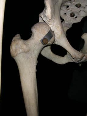 Hip joint: ball-and-socket articulation. 
