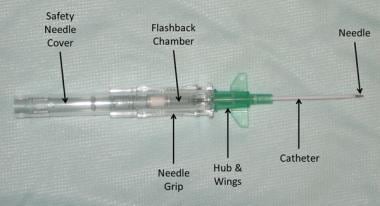 Over-the-needle IV catheter. 