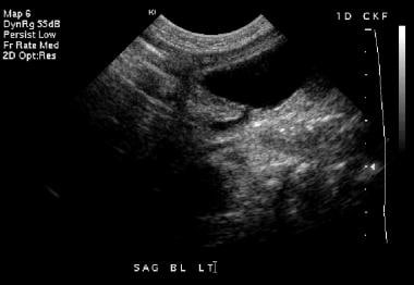 Postnatal sonogram on the first day of life (same 