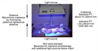Factors that affect phototherapy: The 3 factors th