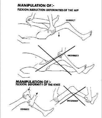 https://img.medscapestatic.com/pi/meds/ckb/28/32728tn.jpg