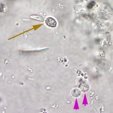 Veterinary Parasite Identification Chart