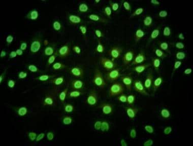 Microphotograph of a fixed Hep-2 line cell prepare