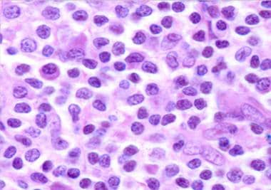Monocytoid B cells and plasmacytoid cells in margi
