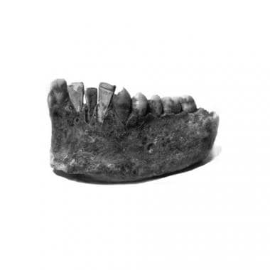 Forensic dentistry (forensic odontology). Mayans c