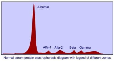 Normal serum protein electrophoresis diagram with