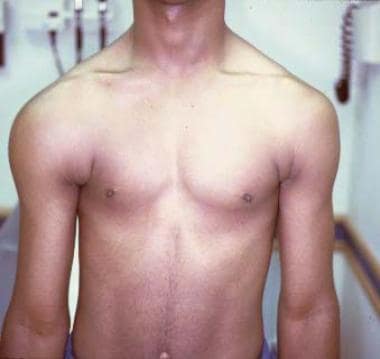 Clinical appearance of a teenager who presented wi