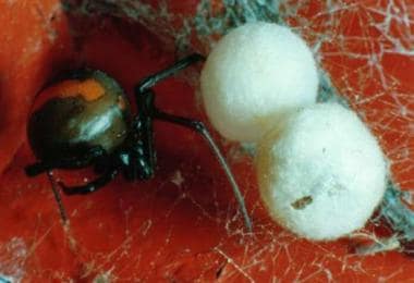 Female redback spider with egg sacs. Image courtes