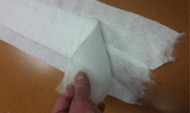 Sugar-tong forearm splinting. Four sheets of splin