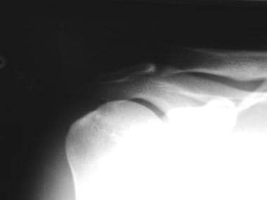 Anteroposterior radiograph of 26-year-old male wei