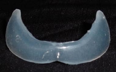 Front view of Brink Peri-Pyriform (tm) silicone im