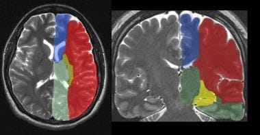 The supratentorial vascular territories of the maj