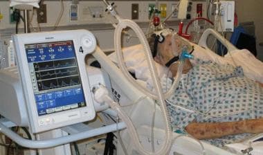 in hospitals the oxygen tubes for respiration contain oxygen and