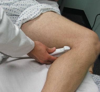 Probe positioning for assessment of the popliteal 