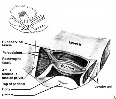 Level II and III detail. In level III, the vagina 