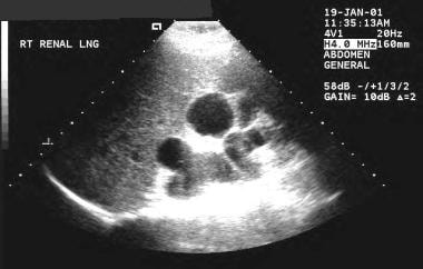 1340. Who needs imaging in UTI? / Pregnancy: UTI predisposing