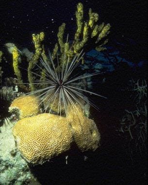 Echinoderm envenomations. Long-spined sea urchins,