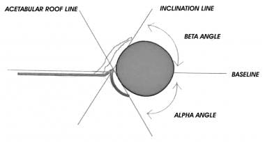 Calculation of the alpha and beta angles to assess