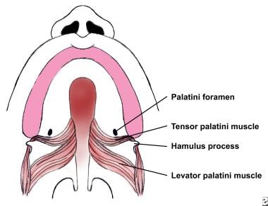 Cleft Lip and Palate and Mouth and Pharynx Deformities: Overview