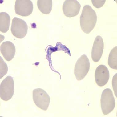 Trypanosoma brucei in a thin blood smear stained w