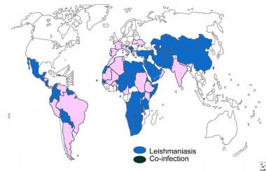 Distribution map of visceral leishmaniasis. 