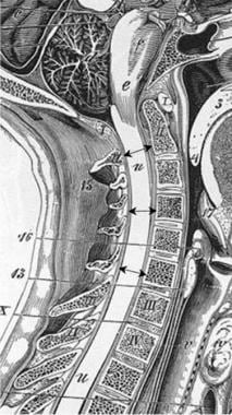 Sagittal measurements taken of the anteroposterior