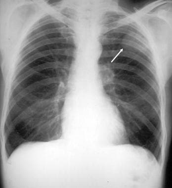 A 53-year-old male smoker presented with lower-lim