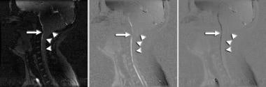 CSF flow study with phase-contrast cine MRI. Brain