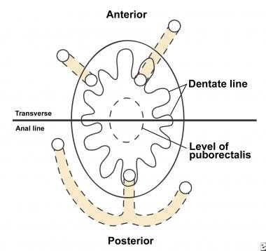 Anal canal - Wikipedia