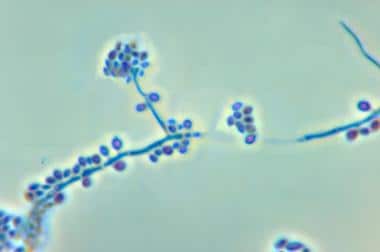 显微照片显示分生孢子梗和c
