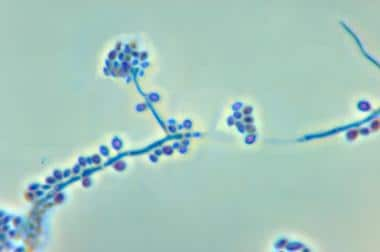 显微照片显示分生孢子和c