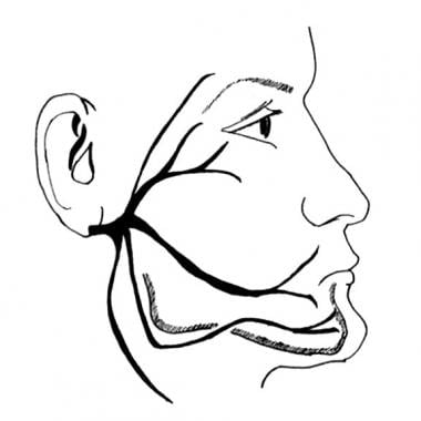Course of the facial nerve. 