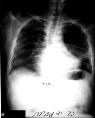 A patient visited central Canada several months ag