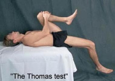 The Thomas test can be used to evaluate restrictio