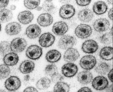 Electron microscopy of human immunodeficiency viru