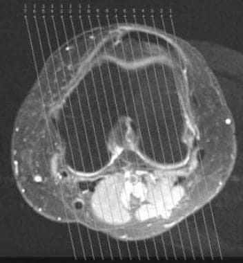 Example of prescribed sagittal images on axial sco