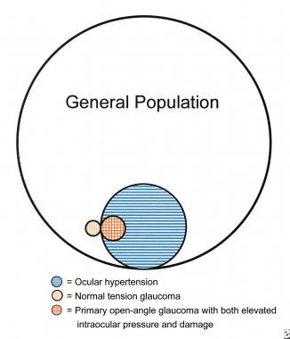 Diagram showing the relative proportion of people 