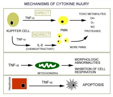 Mechanisms of cytokine injury. IL = interleukin; N