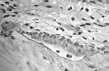 In this image, several osteoblasts display a promi